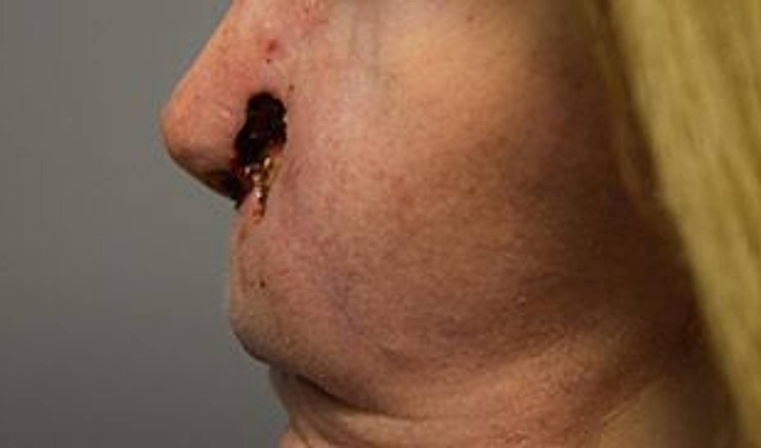 Reconstructive Surgery Before & After Image